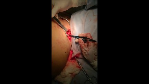 Anastomosis Microcirugía 1