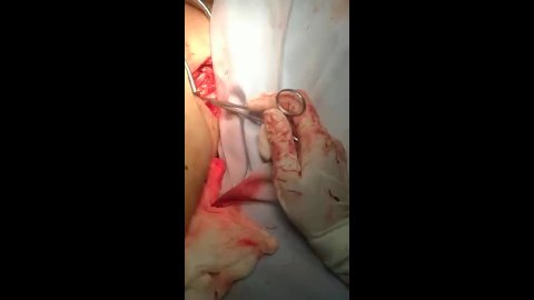 Anastomosis Microcirugía 2