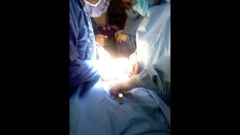 Aplicación En Columna