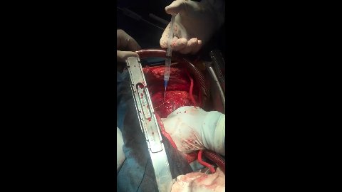 Cardiocirugía Sonora 2