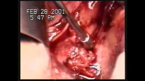 Surgery - Lima, Peru