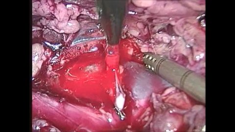 Wortham Excerpts October 2016