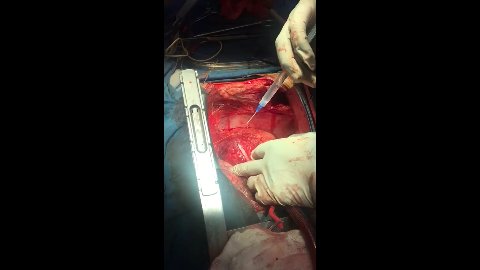 Cardiocirugía Sonora 3