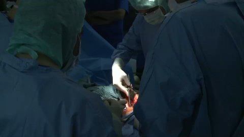 Seraseal Ovar Parenchym (German) 2