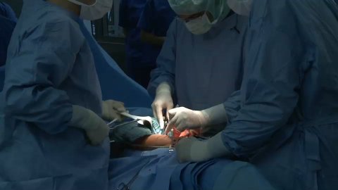 Seraseal Peritonealwunde Uterus (German)